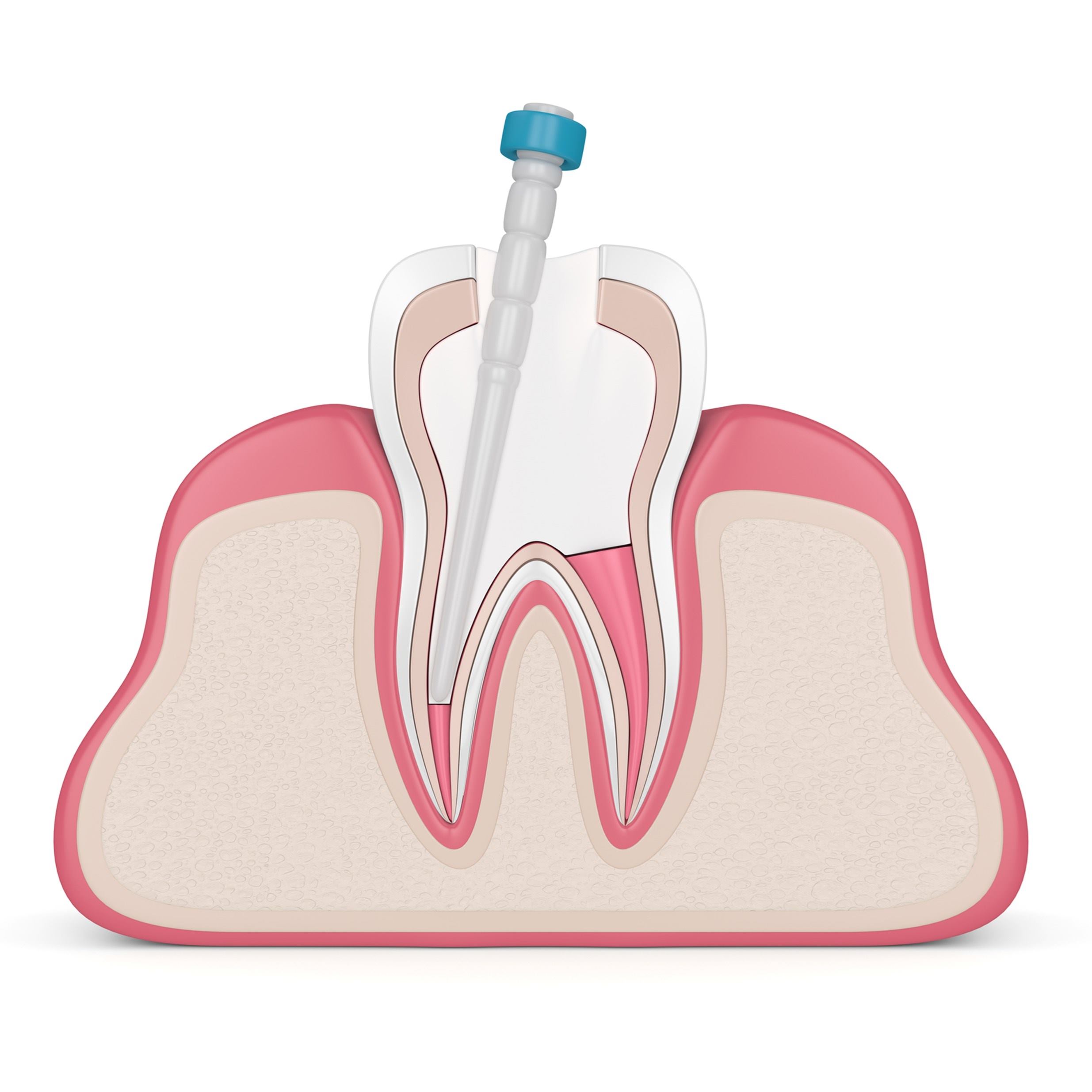 muela_placa_diente_ilustracion_icono_odontologia