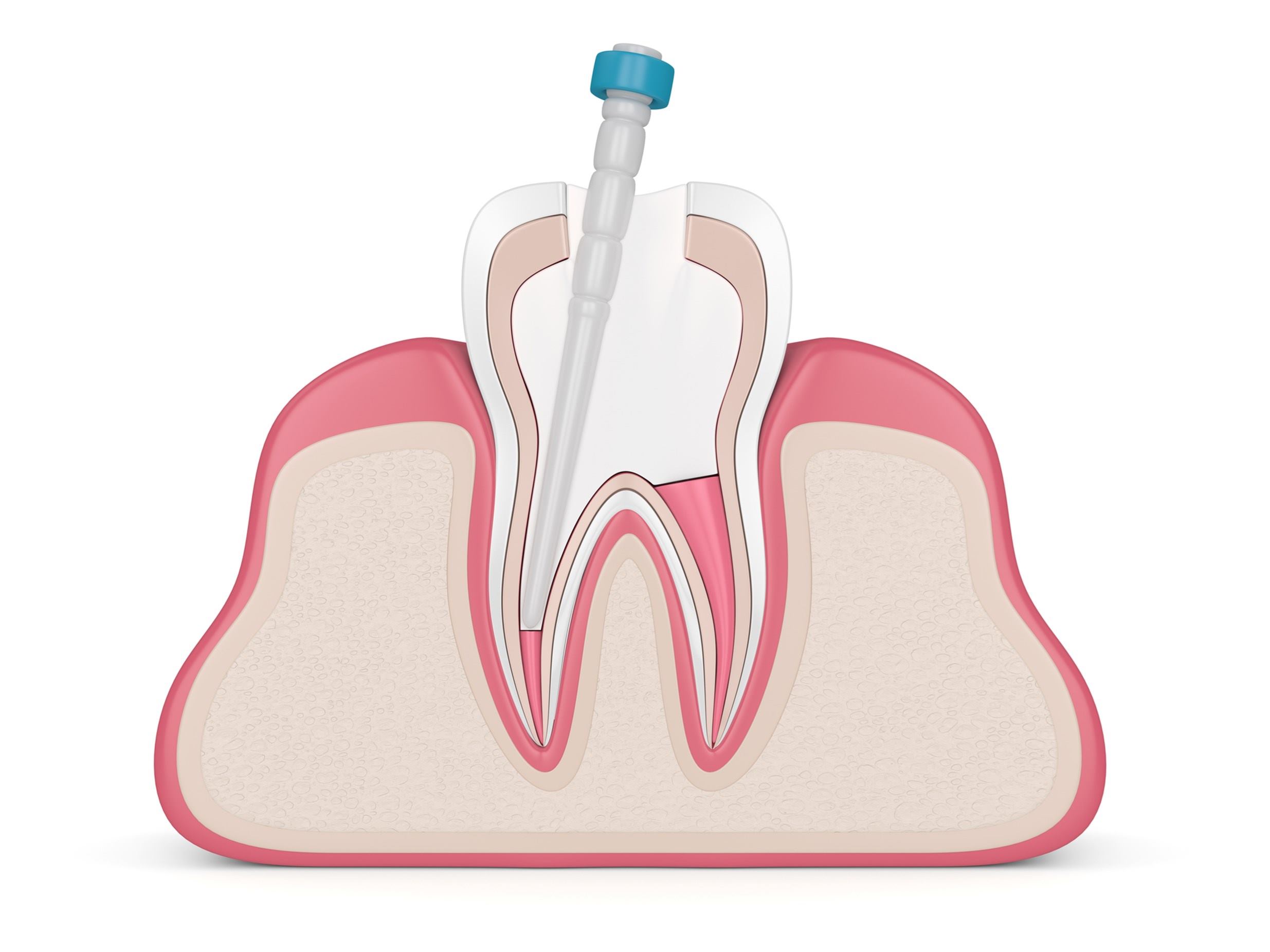 muela_placa_diente_ilustracion_icono_odontologia